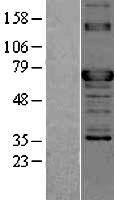 TOR1AIP2 Human Over-expression Lysates NM_145034