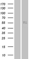 IL28 Receptor alpha (IFNLR1) Human Over-expression Lysates NM_173064