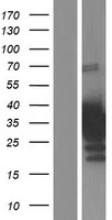 CITED4 Human Over-expression Lysates NM_133467