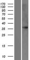FAM43B Human Over-expression Lysates NM_207334