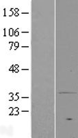 MPRA (PAQR7) Human Over-expression Lysates NM_178422