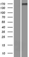 WFDC13 Human Over-expression Lysates NM_172005
