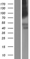 ls164312 lrrn4 human over expression lysates nm 152611 wb testing 1