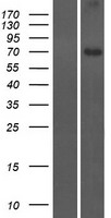 CCDC116 Human Over-expression Lysates NM_152612