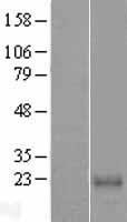 Calcium binding protein 7 (CABP7) Human Over-expression Lysates NM_182527