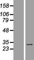WBP2NL Human Over-expression Lysates NM_152613