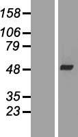 WDR69 (DAW1) Human Over-expression Lysates NM_178821