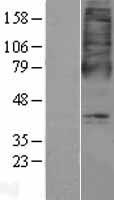 ls165140 oxer1 human over expression lysates nm 148962 wb testing 1
