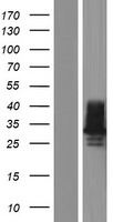 C1QL2 Human Over-expression Lysates NM_182528