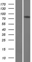 DQX1 Human Over-expression Lysates NM_133637