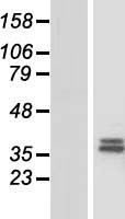 CHST13 Human Over-expression Lysates NM_152889