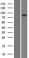 DCAMKL2 (DCLK2) Human Over-expression Lysates NM_001040260