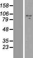 ZNF509 (ZBTB49) Human Over-expression Lysates NM_145291