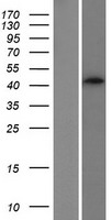 ls166929 sphingomyelin synthase 2 sgms2 human over expression lysates nm 001136258 wb testing 3