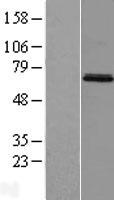 MIER3 Human Over-expression Lysates NM_152622