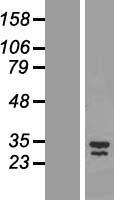 LIX1 Human Over-expression Lysates NM_153234