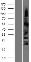 OLIG3 Human Over-expression Lysates NM_175747