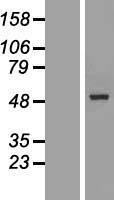ls168391 galntl5 human over expression lysates nm 145292 wb testing 1