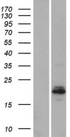 BHLHA15 Human Over-expression Lysates NM_177455