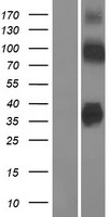 Zinc transporter 8 (SLC30A8) Human Over-expression Lysates NM_173851
