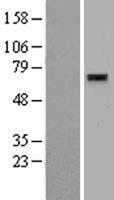 ls169270 znf596 human over expression lysates nm 001042415 wb testing 2