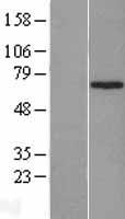 ZNF169 Human Over-expression Lysates NM_194320