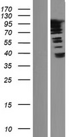 SUPT20HL2 Human Over-expression Lysates NM_001136233
