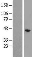 ZCCHC12 Human Over-expression Lysates NM_173798