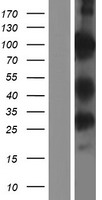 PWWP domain containing protein 2B (PWWP2B) Human Over-expression Lysates NM_001098637