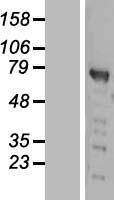 PWWP domain containing protein 2B (PWWP2B) Human Over-expression Lysates NM_138499
