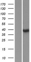 SSBP4 Human Over-expression Lysates NM_032627