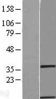 ls170575 gimap1 human over expression lysates nm 130759 wb testing 1