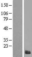 S100Z Human Over-expression Lysates NM_130772