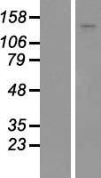 ADAMTS18 Human Over-expression Lysates NM_199355