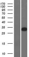 GSH2 (GSX2) Human Over-expression Lysates NM_133267