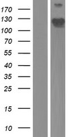 Phostensin (PPP1R18) Human Over-expression Lysates NM_133471