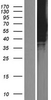 ZNF384 Human Over-expression Lysates NM_001039916