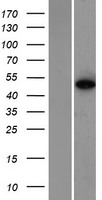 ZNF384 Human Over-expression Lysates NM_001039920