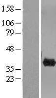 CLYBL Human Over-expression Lysates NM_206808