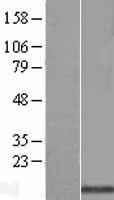 SPTSSA Human Over-expression Lysates NM_138288