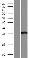 C9orf21 (AAED1) Human Over-expression Lysates NM_153698