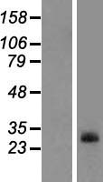 ls196051 ppapdc1a plpp4 human over expression lysates nm 001030059 wb testing 1