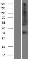 OR56B4 Human Over-expression Lysates NM_001005181