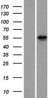 KRT78 Human Over-expression Lysates NM_173352