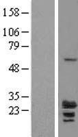 RILPL2 Human Over-expression Lysates NM_145058