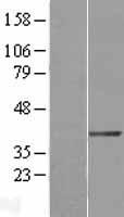 ls196403 dtx3 human over expression lysates nm 178502 wb testing 1