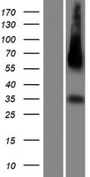 C14orf183 (LINC01599) Human Over-expression Lysates NM_001014830