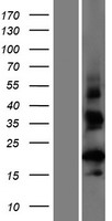 CT62 Human Over-expression Lysates NM_001102658