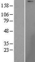 UBR1 Human Over-expression Lysates NM_174916