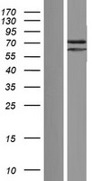 PATL2 Human Over-expression Lysates NM_001145112